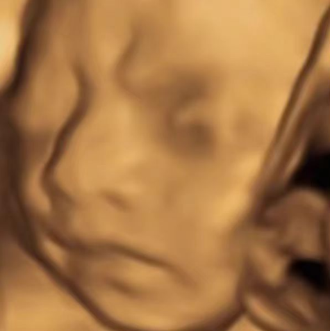 AI四维彩超预测,一单9.9-98,3分钟出图,一天变现1000+